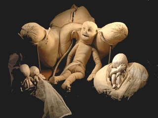 Illustration for article titled Check Out This Crazy Fabric Womb From the 18th Century